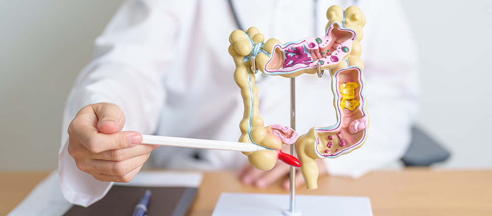 Doctor with human colon anatomy model